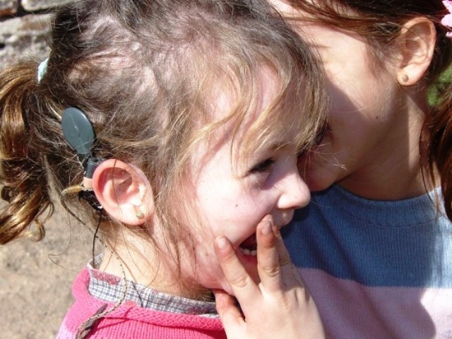 Argentina llegará a los 100 niños con implante coclear gratuito